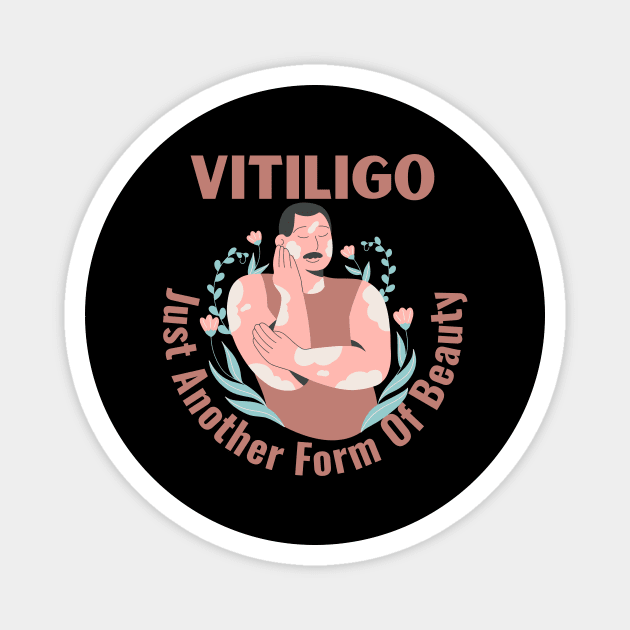Vitiligo Just Another Form Of Beauty Male Model Magnet by Designs by Mim